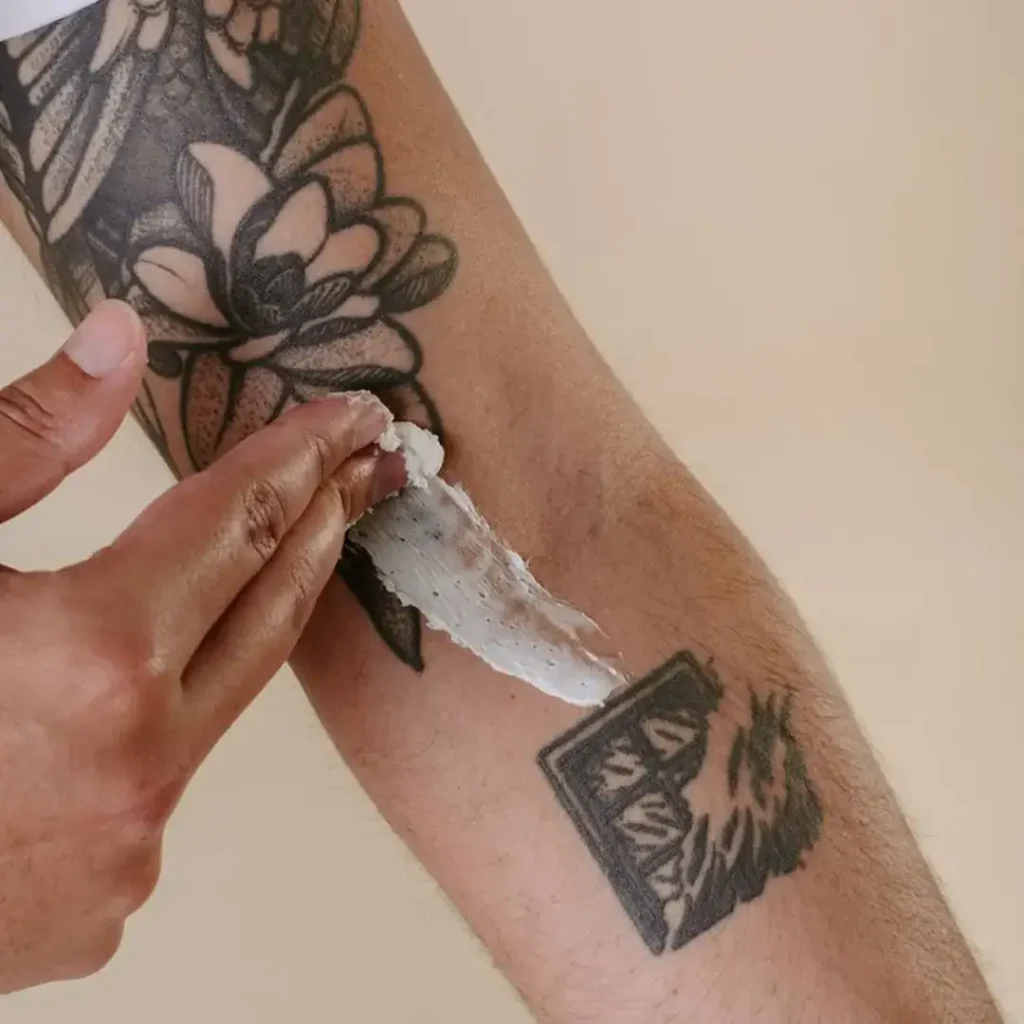 Tattoo regret and removal process with topical cream applied on forearm tattoo for aftercare